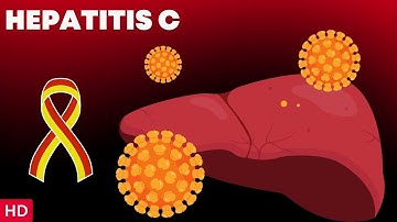 What is Hepatitis C? Causes, Symptoms, Transmission, Diagnosis & Treatment