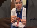 الورم الليفي والحمل د أميرة النجار