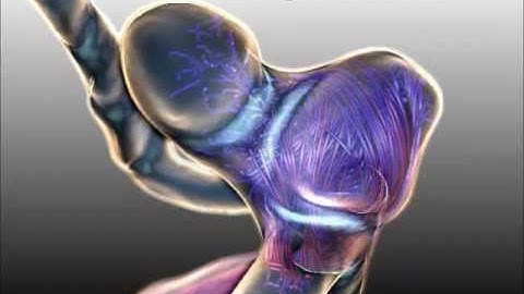 Adaptive Surface Visualization of Vessels