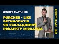 ⭐️Мартинов Дмитро Валерійович. Purcher - like ретинопатія як ускладнення інфаркту міокарда