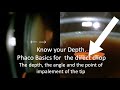 Know your depth  direct phaco chop basics  the depth  the angle  and the point of impalement 