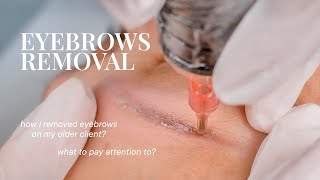 How To Remove Eyebrows On Older Skin