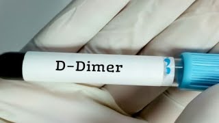 تحليل D-Dimer.