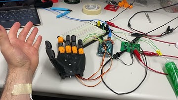 Demonstration - Prosthetic Control Using Surface Electromyography