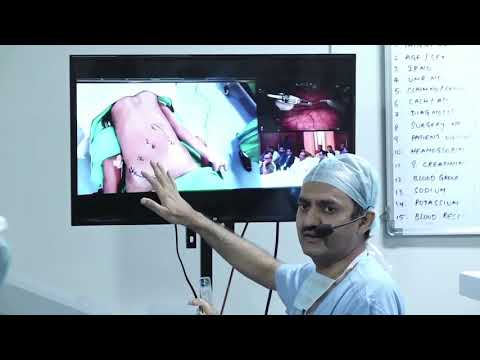  Robotic LAR Vizac Liver surgery Vizac MGOncoCon July 7 2019with audio