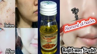 Top 5 Almond oil uses & benefits | How to use almond oil for face | Almond oil hacks