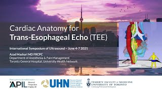 Cardiac Anatomy for Trans-Esophageal Echocardiography (TEE) - Azad Mashari