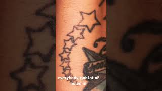 neatcell laser tattoo removal laser session one #laserremoval #neatcell #tattooremoval #easylaser