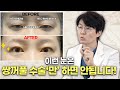 쌍꺼풀 수술 `만` 하면 안되는 유형이 있다고...?