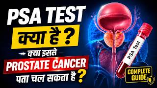PSA Test क्या है? | क्या PSA Test से Prostate Cancer पता चल सकता है? 🚨