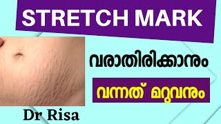 Stretch Marks വരാതിരിക്കാൻ | How to Remove Stretch Marks Malayalam