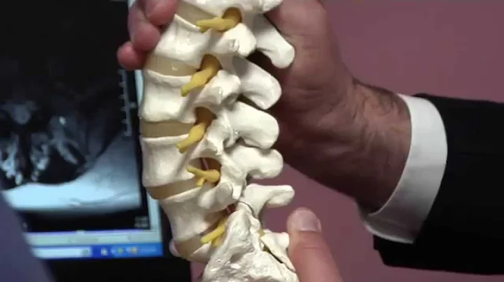UP HealthBreak: Dr. Craig Coccia, Spinal Stenosis