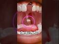 These are the Shocking Things That Happen If You Swallow a Tooth 😱