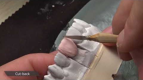 EX-3 for Speed Enamel Build-up Technique by Alek Aronin