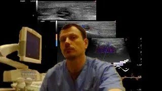 Pediatric Soft tissue ultrasound - Foot pain screenshot 5