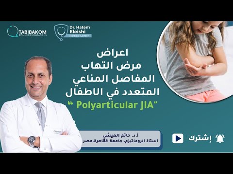 أ د حاتم العيشي   اعراض مرض التهاب المفاصل المناعي المتعدد في الاطفال