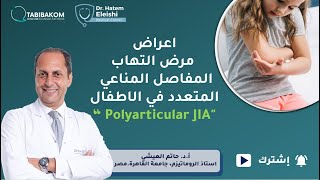 أ.د. حاتم العيشي (poly JIA) اعراض مرض التهاب المفاصل المناعي المتعدد في الاطفال