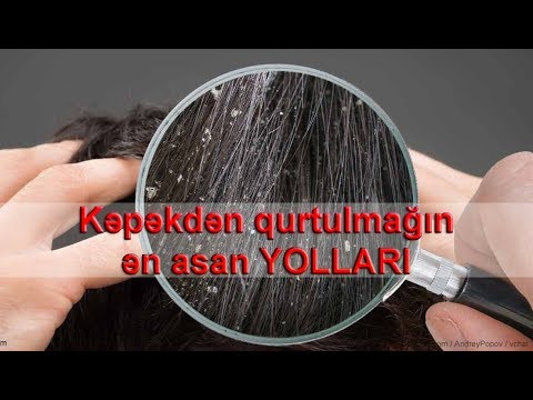 Video: Kəpək Necə Bişirilir