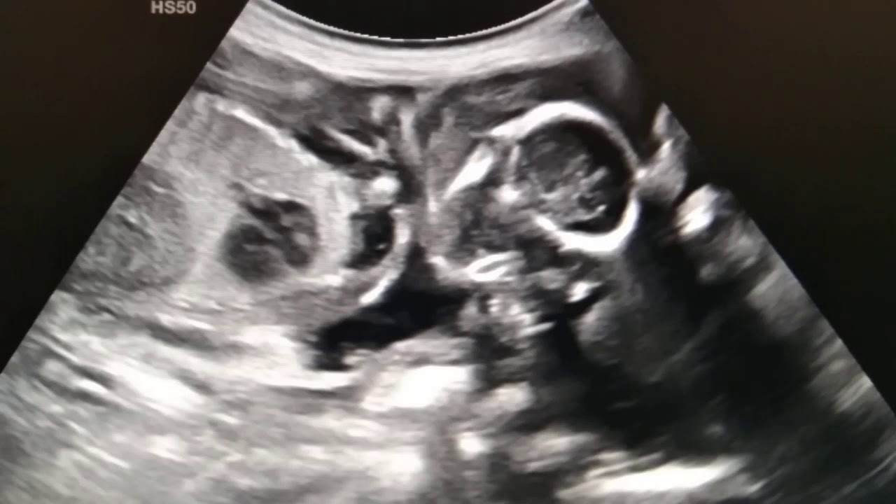 Ultrasound of puppy YouTube