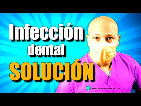 Video: 3 formas de combatir la infección bucal