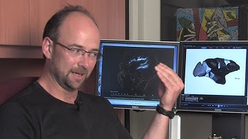 Randy McIntosh - Director, Rotman Research Institute, Baycrest - 1Mtweets