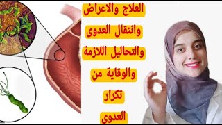 أحدث نظام علاجى للقضاء نهائيا على جرثومة المعدة في أسبوعين فقط/ ليه العلاج الثلاثي والرباعى مش فعال!