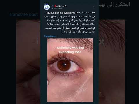 متلازمه صيد المخاط    دكتور سيرجن