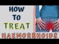 HOW TO TREAT HAEMORRHOIDS AT HOME- PILES HOME REMEDIES