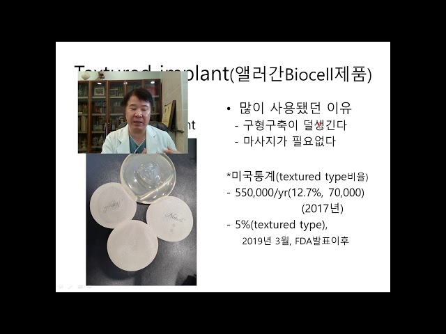 유방보형물과 악성임프종의 관계는(2부)?