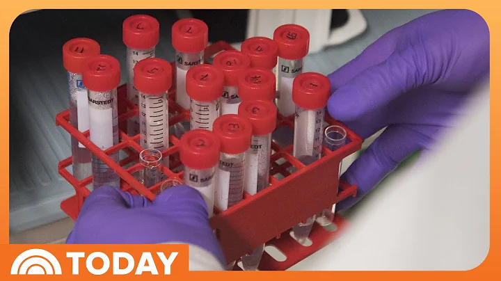 New study shows how effective immunotherapy is at battling cancer