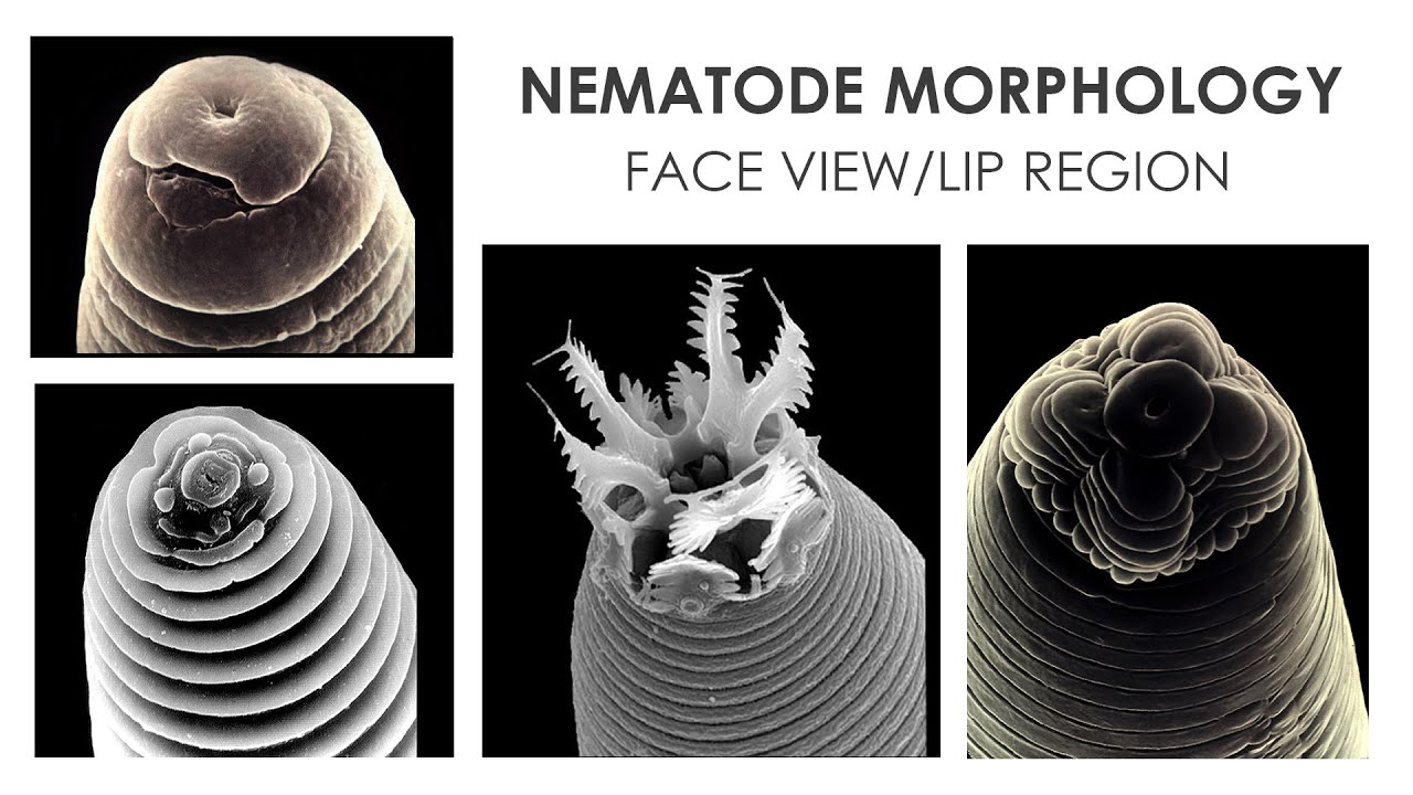 NEMATODE MORPHOLOGY: FACE VIEW 