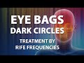 Eye bags  dark circles  rife frequencies treatment  energy  quantum medicine with bioresonance