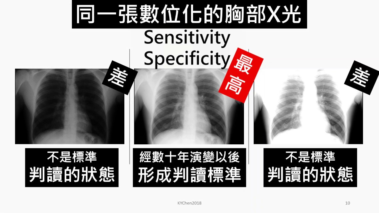 Problems in reading of PACS chest X ray film 2019