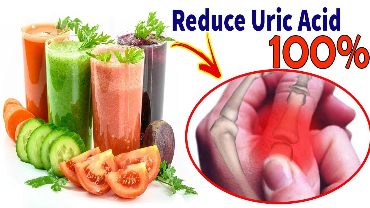 [GOUT TREATMENT] How To Cure Gout Naturally At Home And Naturally