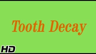 Tooth decay, Causes, Signs and Symptoms, Diagnosis and Treatment.