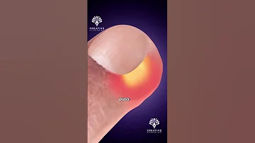 Stop Peeling Hangnails Shorts Youtubeshorts Creativelearning3d 