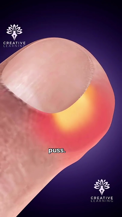 Stop Peeling Hangnails! 😲 #shorts #youtubeshorts - creativelearning3d