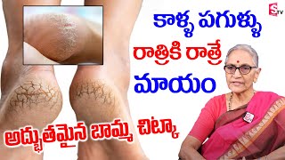 Dr Anantha Lakshmi - Cracked Heels Home Remedy Cream | Natural Foot Cream || SumanTV Mom