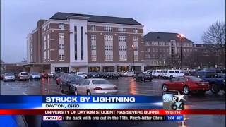 University of Dayton student struck by lightning