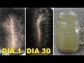 Poderoso Tónico que Acaba con la Calvicie y hace Crecer el Cabello