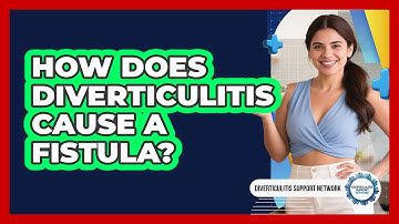 How Does Diverticulitis Cause A Fistula? - Diverticulitis Support Network