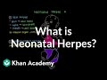 Neonatal Herpes Quiz