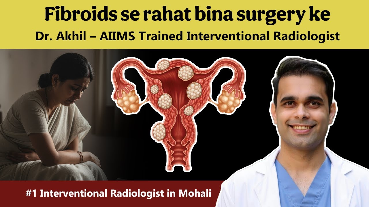 Do You Really Need Surgery for Fibroids? Expert Advice by Dr. Akhil Monga