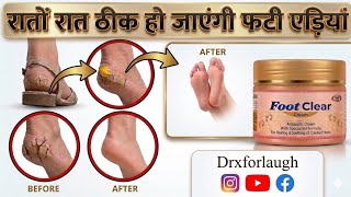 Creak heel ke leye cream | footclear cream || Creak heal wali cream kase kaam kartii hai ?