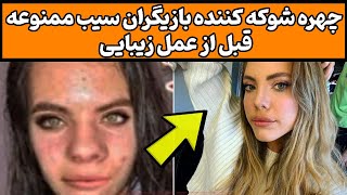 تغییر چهره شوکه کننده بعد از عمل زیبایی بازیگران سریال سیب ممنوعه