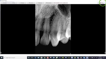 Training: Apteryx XVWeb: Taking an FMX in XVCapture