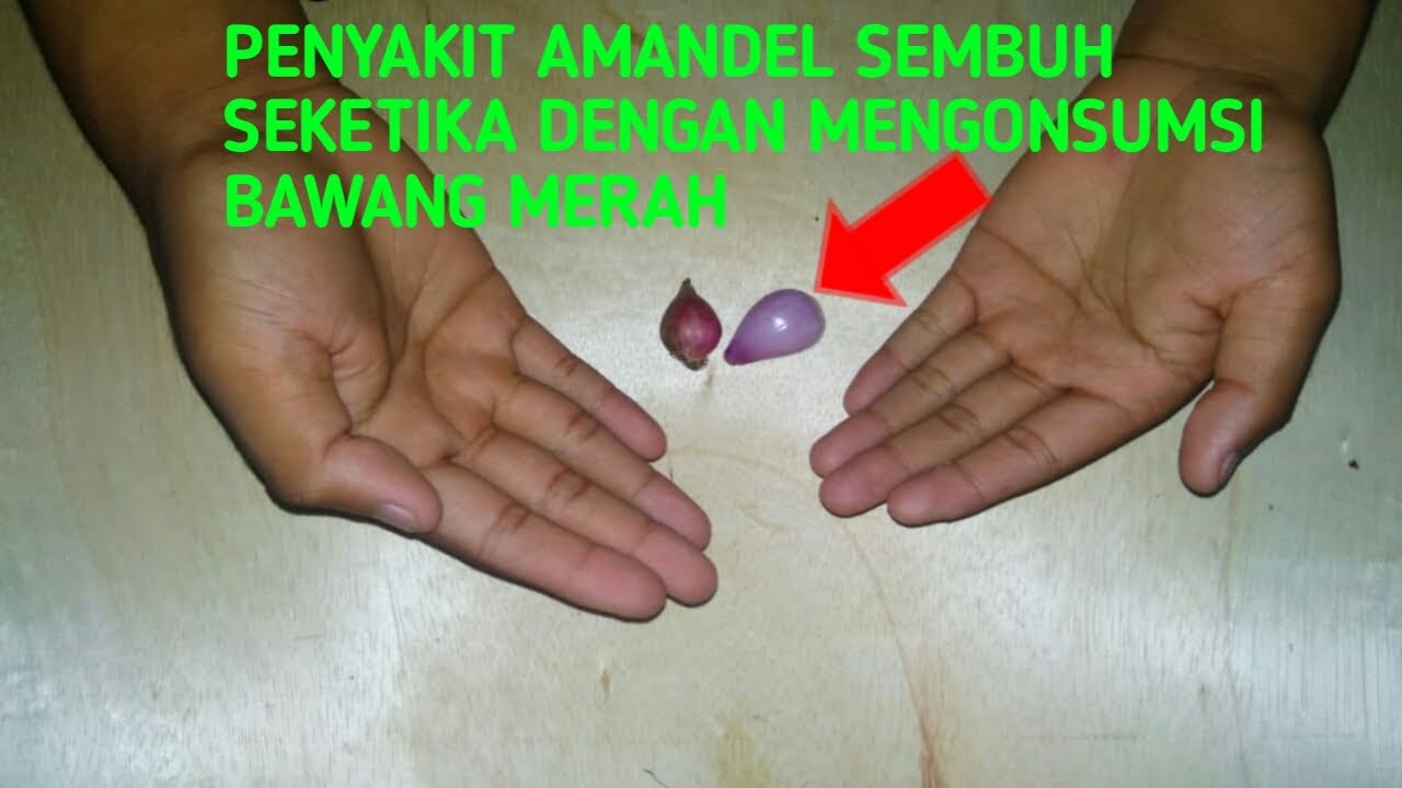 BEGINI CARA ALAMI MENGATASI SAKIT AMANDEL DENGAN CEPAT CUKUP DENGAN