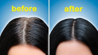 How To Turn White Or Grey Hair Into Black Naturally