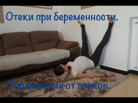 Отеки при беременности. Что делать? Упражнения от отеков.