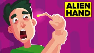 Alien Hand Syndrome